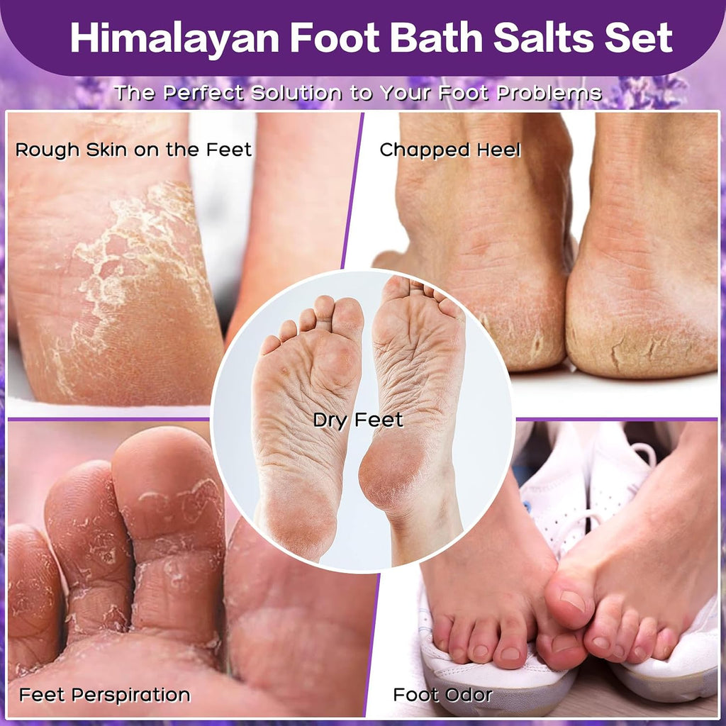 XIWEIOO Kit Sales para Baño de Pies 4 Pack 56 oz | Sal Himalaya, Lavanda, Naranja, Rosa | Aceite de Árbol de Té | Pedicura y Cuidado de Pies