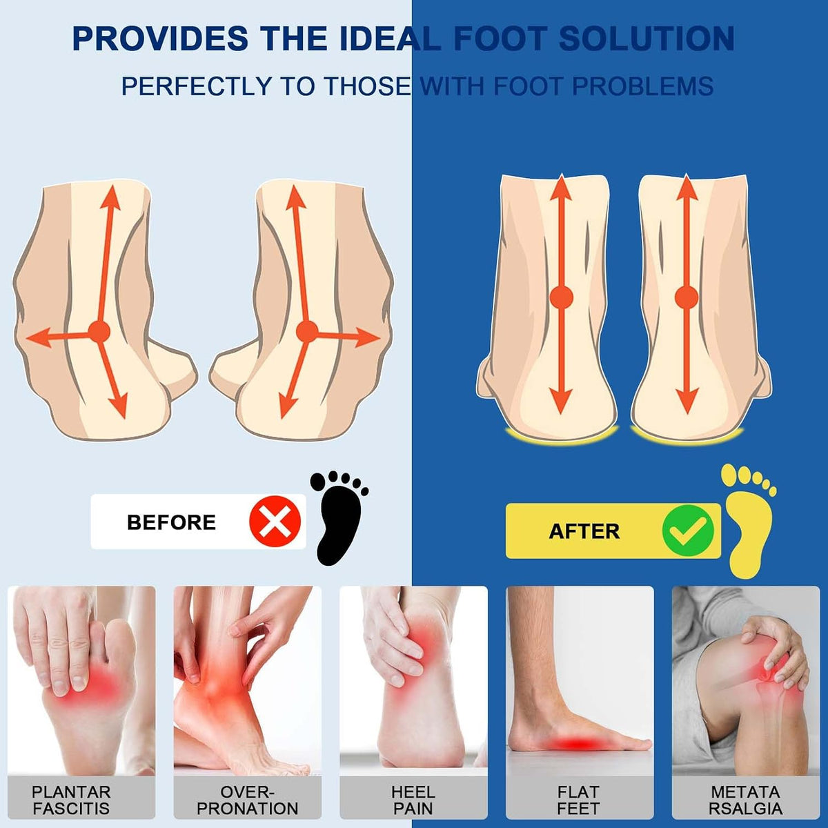 TALLA M-Plantillas Crinova para mujer, plantillas de apoyo de arco para fascitis plantar, plantillas atléticas ortopédicas para correr, botas de trabajo, plantillas de arco alto para pies planos, dolor de arco, espolones de talón, sobrepronación
