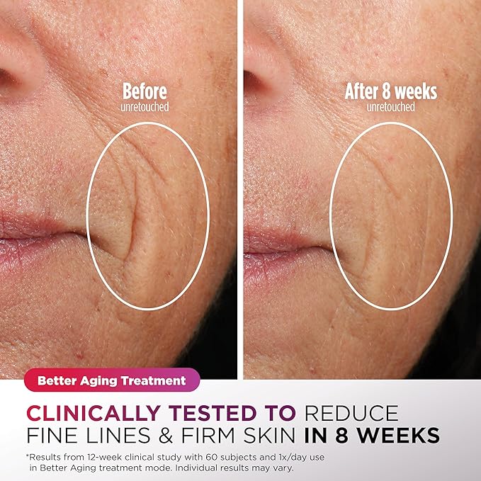 Shark CryoGlow Máscara LED Facial – Enfriamiento Contorno de Ojos, Antienvejecimiento y Terapia de Luz Infrarroja